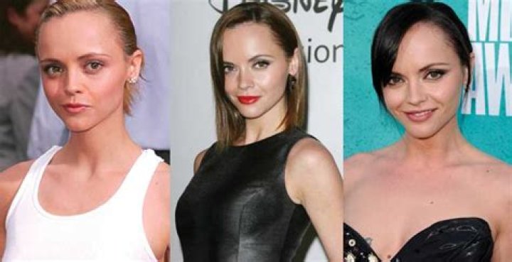 Christina Ricci Plastic Surgery Before and After