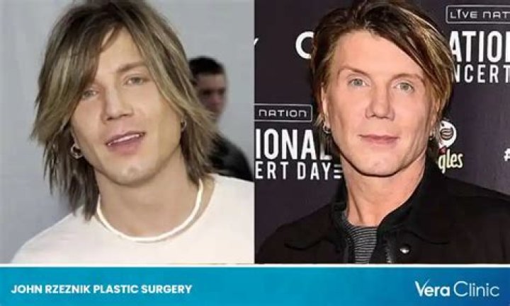Johnny Rzeznik Plastic Surgery: A Deep Dive Into the Transformation