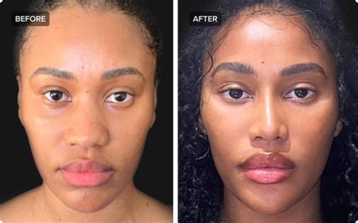 Kerry Washington Nose Job Plastic Surgery Before and After