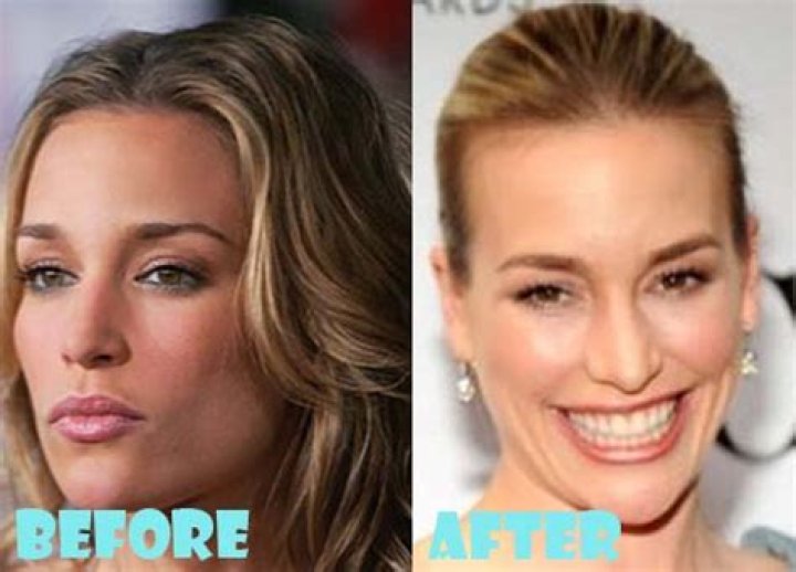 Piper Perabo Plastic Surgery Before and After